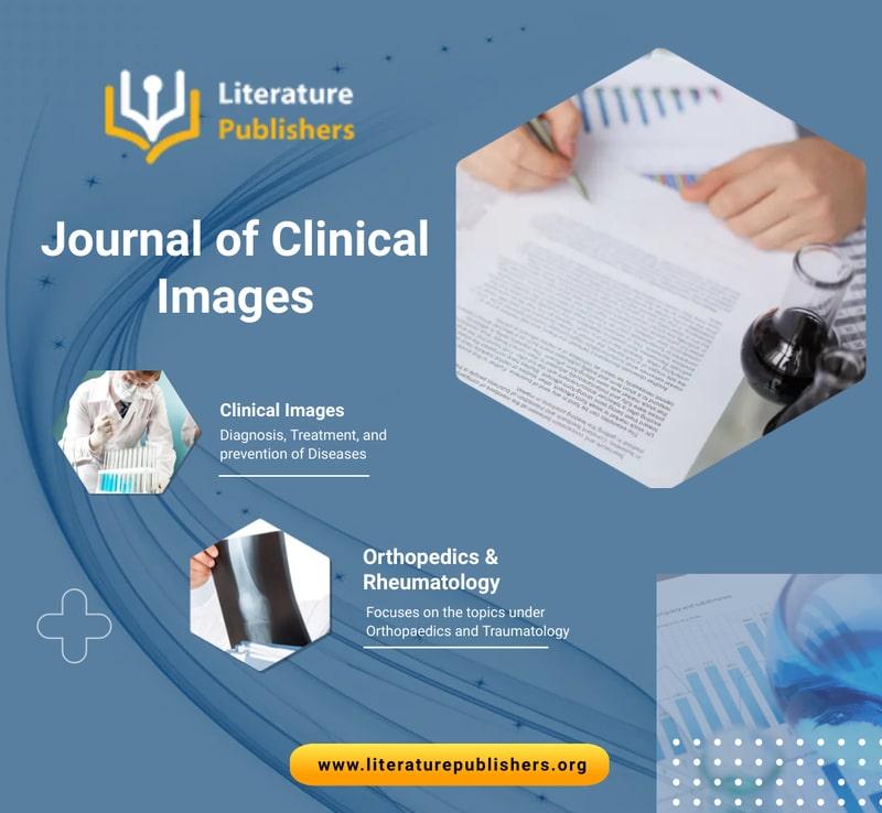 Journal of Clinical Images And Medical Case Reports