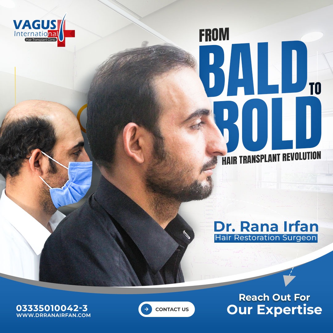 Hair Transplant service in Islamabad , pakistan